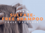 Does Sulfate-free Shampoo Cause Dandruff image