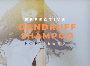 best dandruff shampoo for teenager image