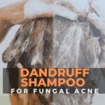 Best Dandruff Shampoo for Fungal Acne